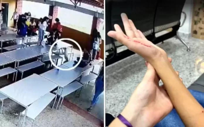 Pit bull invade escola e deixa 3 crianças feridas